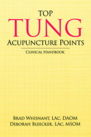 Top Tung Acupuncture Points