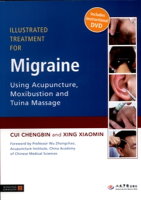 Illustrated Treatment for Migraine w/ Acupuncture