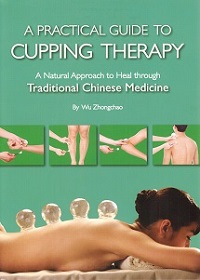 A Practical Guide to Cupping Therapy