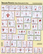 Trigger Point Charts (2pcs), 23" x28"