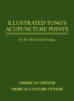 Illustrated Tungs Acupuncture Points