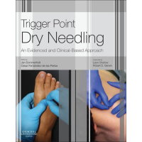 Trigger Point Dry Needling: An Evidence and Clinical-Based Approach